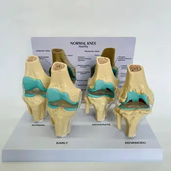 1 шт Анатомический Скелет человека в натуральную величину 4-Ступенчатая Анатомическая модель коленного сустава Учебные принадлежности